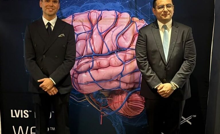 Nueva alternativa contra aneurismas cerebrales